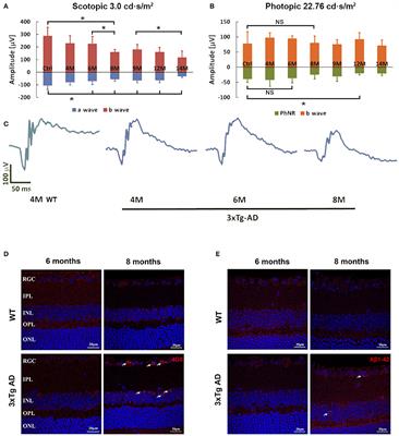 Preservation of Retinal Function Through Synaptic Stabilization in Alzheimer's Disease Model Mouse Retina by Lycium Barbarum Extracts